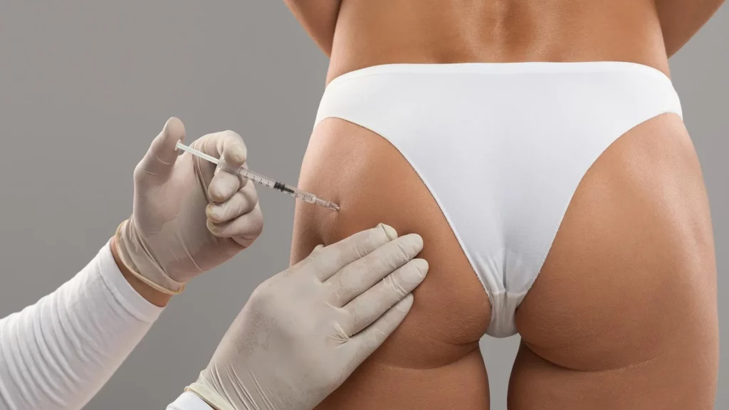 Aumento de glúteos con ácido hialurónico en clínica médica en Málaga