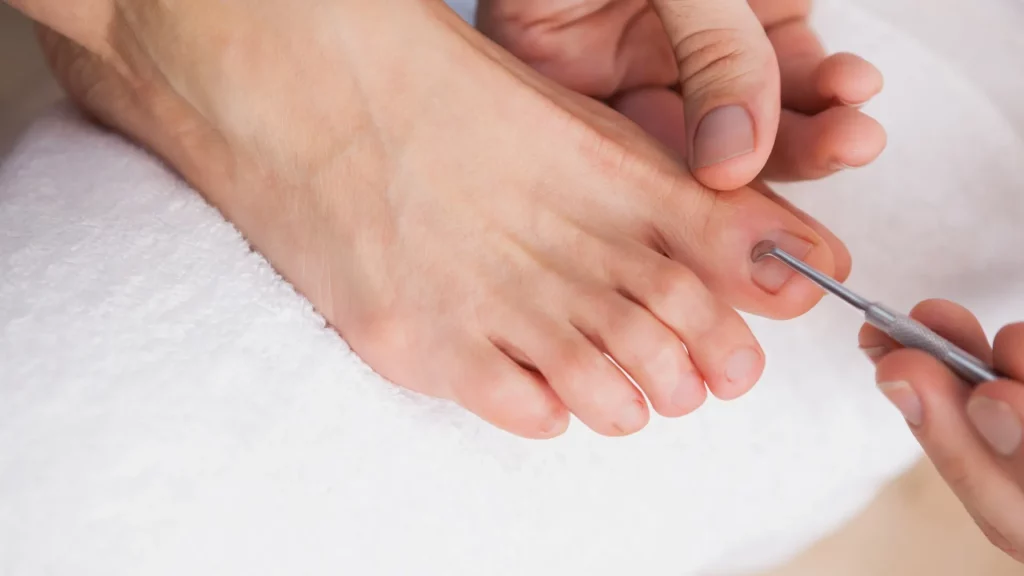 Pedicura spa con esmaltado tradicional en clínica estética en Málaga para cuidar y relajar los pies