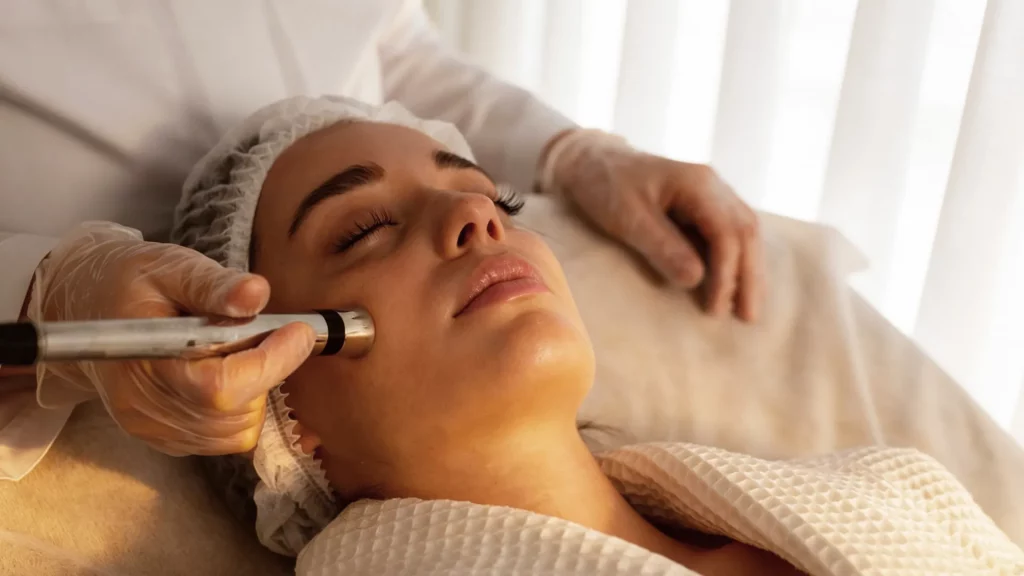 Tratamiento despigmentante con microneedling en clínica estética en Málaga para mejorar manchas y tono irregular