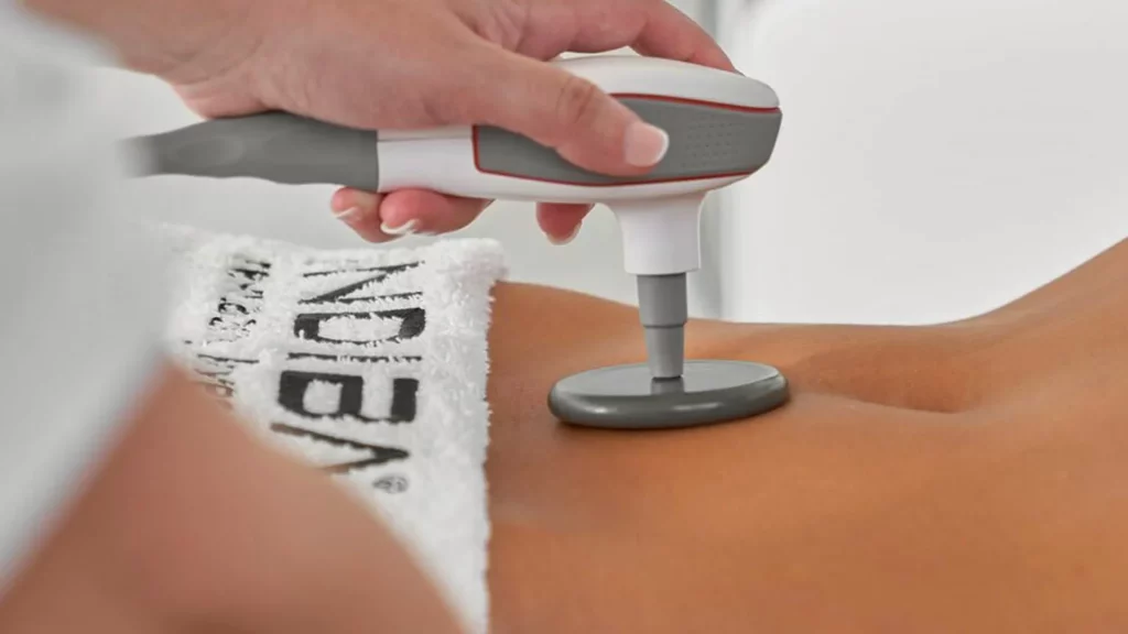 Indiba recuperación post parto en clínica estética en Málaga para regeneración y recuperación corporal