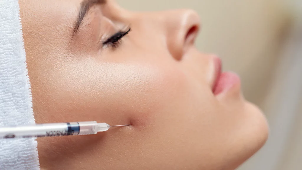 mesoterapia facial en Málaga para hidratación y revitalización de la piel